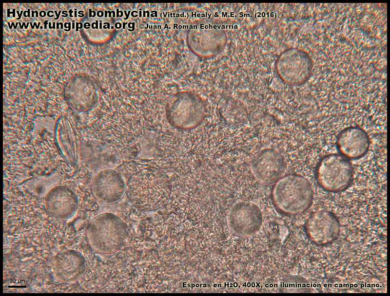 Hydnocystis_bombycina_Microscopia_Microscopy3-3.jpg
