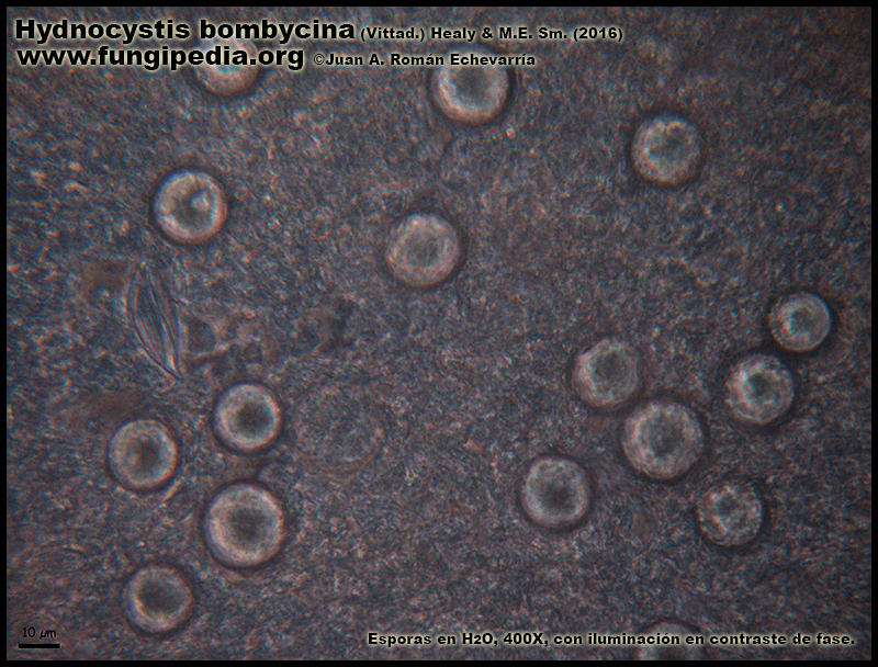 Hydnocystis_bombycina_Microscopia_Microscopy3-5.jpg