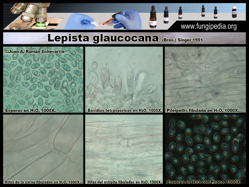Lepista_glaucocana_Microscopia_Microscopy2.jpg
