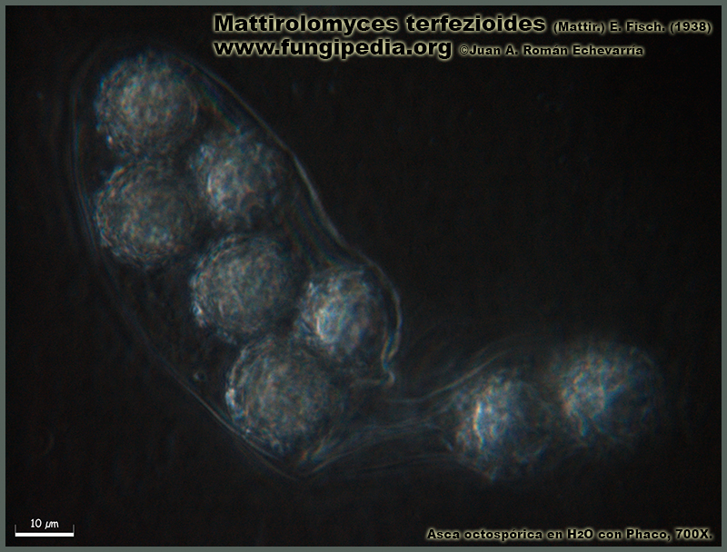 Mattirolomyces_terfezioides_Microscopia_Microscopy2-4.jpg
