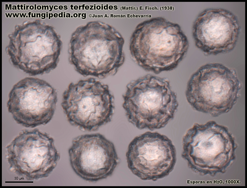 Mattirolomyces_terfezioides_Microscopia_Microscopy4-2.jpg