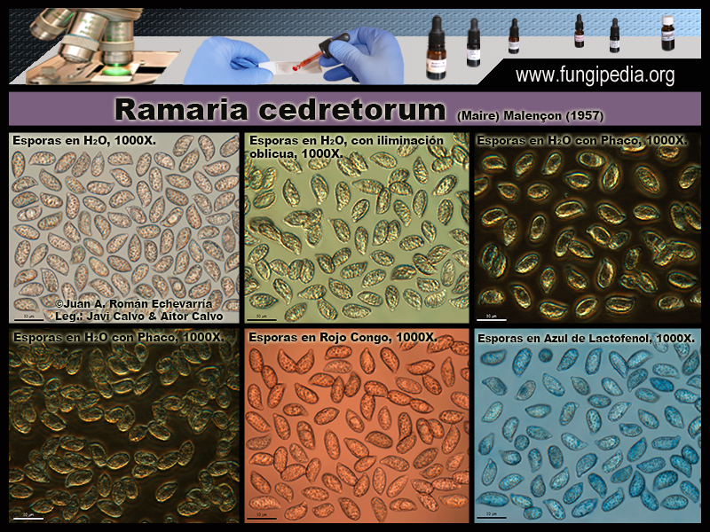 Ramaria_cedretorum_Microscopia_Microscopy3.jpg