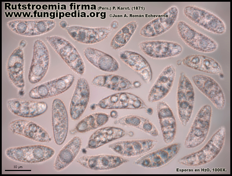 Rutstroemia_firma_Microscopy8_2.jpg