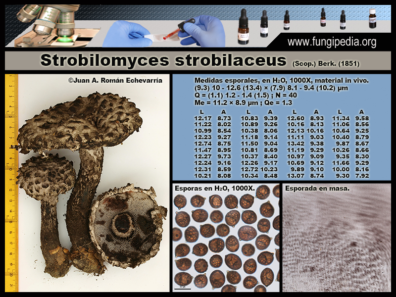 Strobilomyces_strobilaceus_Microscopia_Microscopy1_2020-10-29.jpg