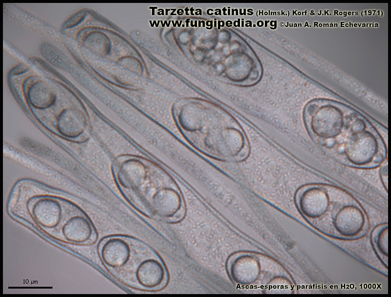 Tarzetta_catinus_Microscopia_Microscopy9-1.jpg