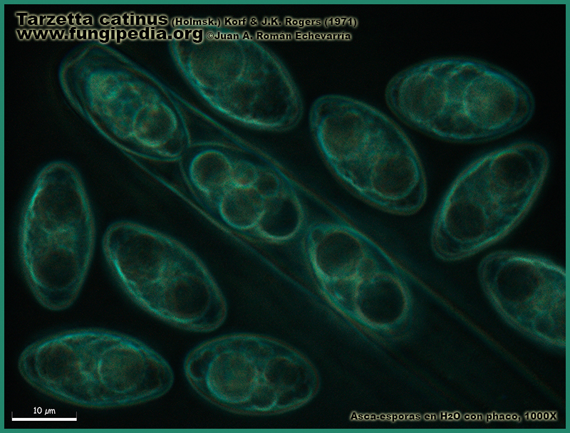 Tarzetta_catinus_Microscopia_Microscopy9-5.jpg