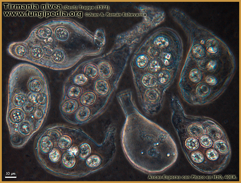 Tirmania_nivea_Microscopia_Microscopy1.jpg