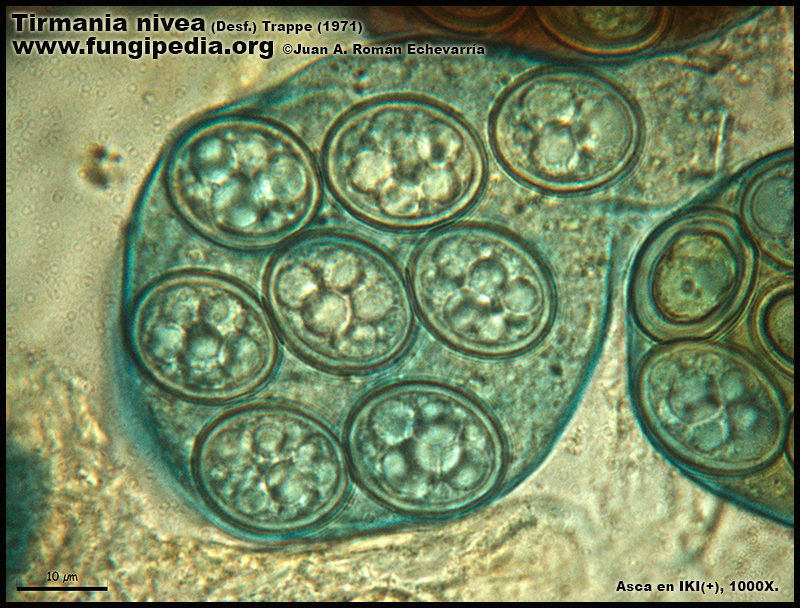 Tirmania_nivea_Microscopia_Microscopy9-5.jpg