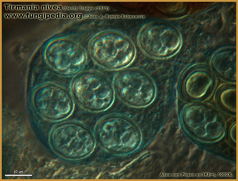 Tirmania_nivea_Microscopia_Microscopy9-6.jpg