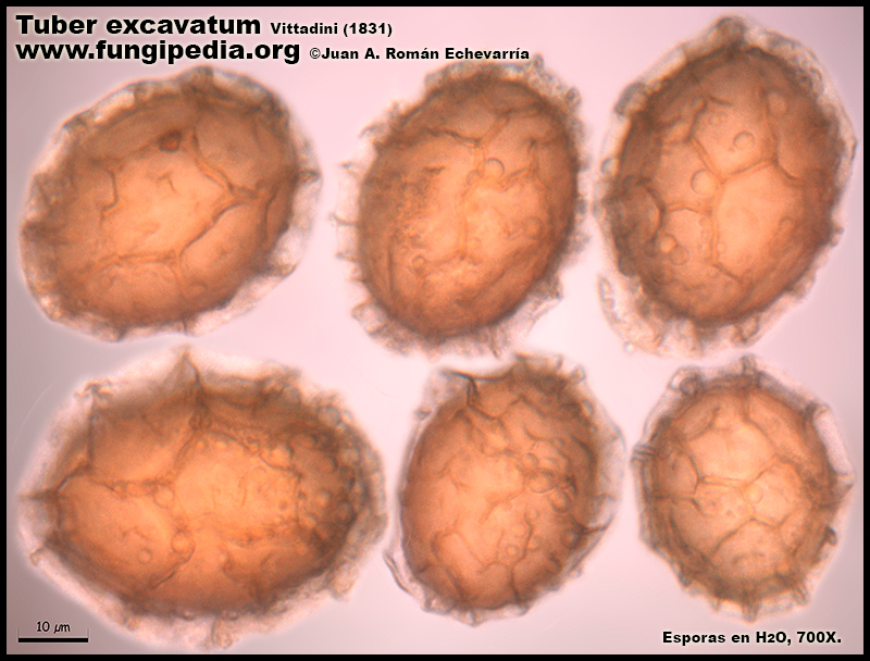 Tuber_excavatum_Microscopia_Microscopy2-5.jpg
