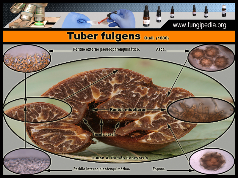 Tuber_fulgens_Microscopia_Microscopy1-3.jpg