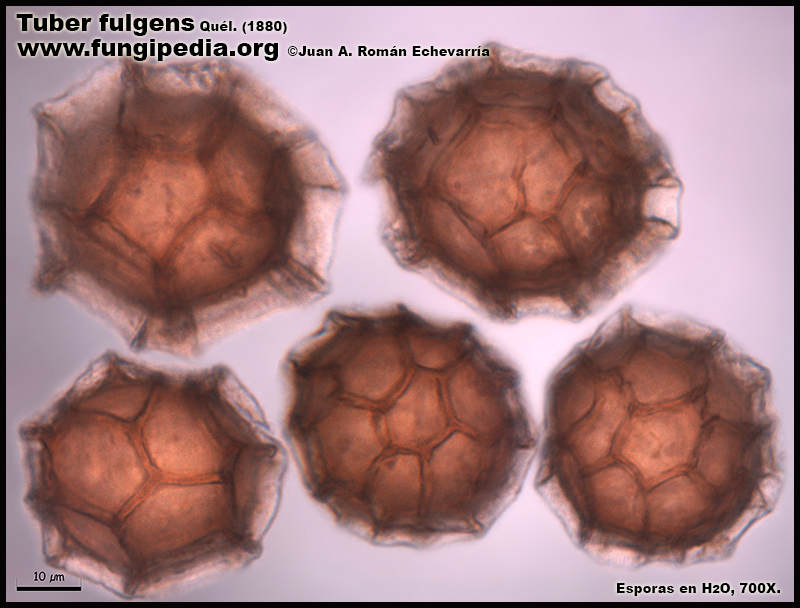Tuber_fulgens_Microscopia_Microscopy3-1.jpg