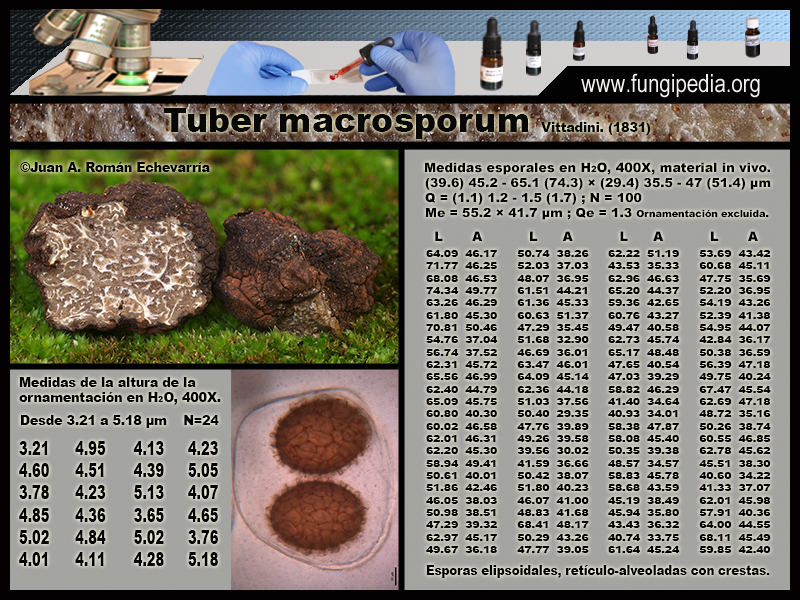 Tuber_macrosporum_Microscopia_Microscopy1.jpg