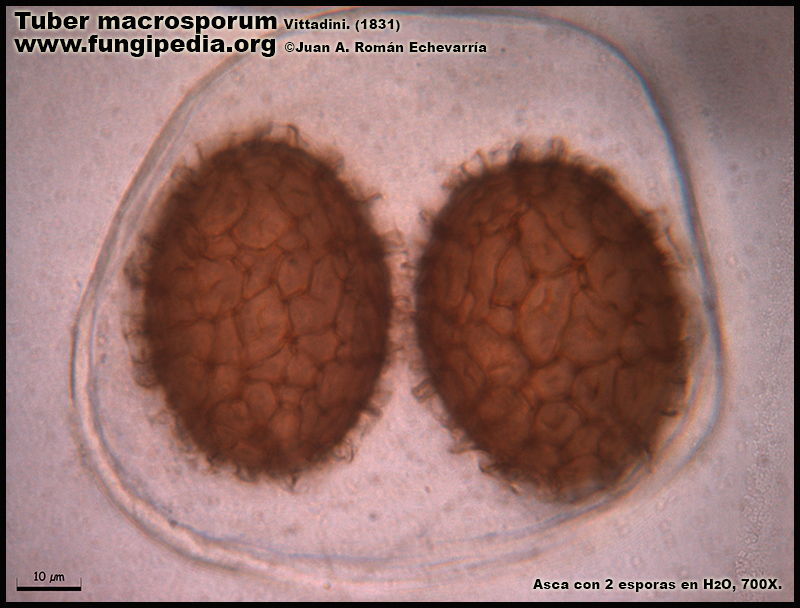 Tuber_macrosporum_Microscopia_Microscopy5-3.jpg