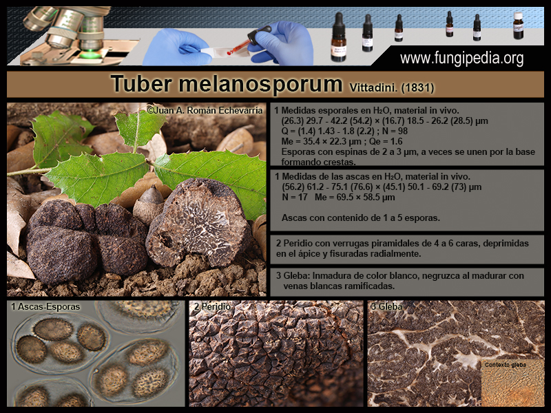 Tuber_melanosporum_Microscopy_2021-12-27.jpg