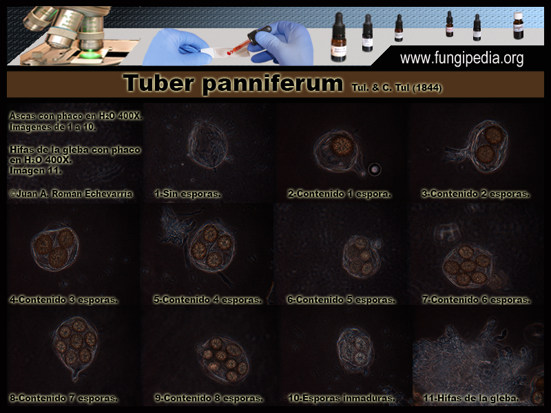 Tuber_panniferum_Microscopia1-2.jpg
