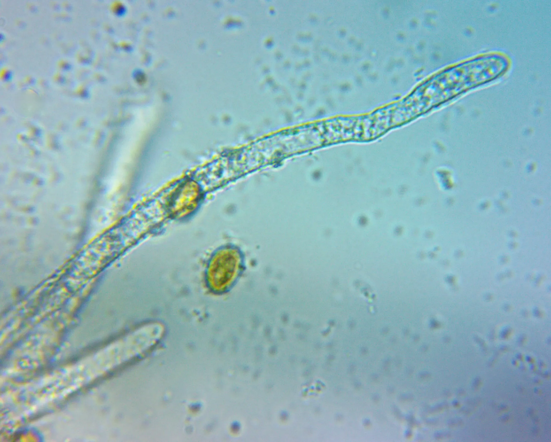 Microscopía de Coniophora olivacea - cistidio(1)