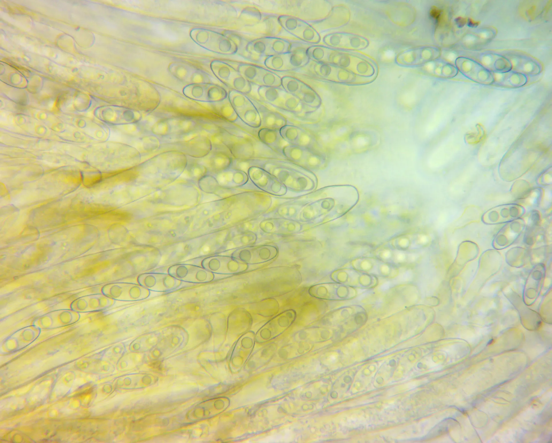 Microscopía de Gyromitra infula - ascos
