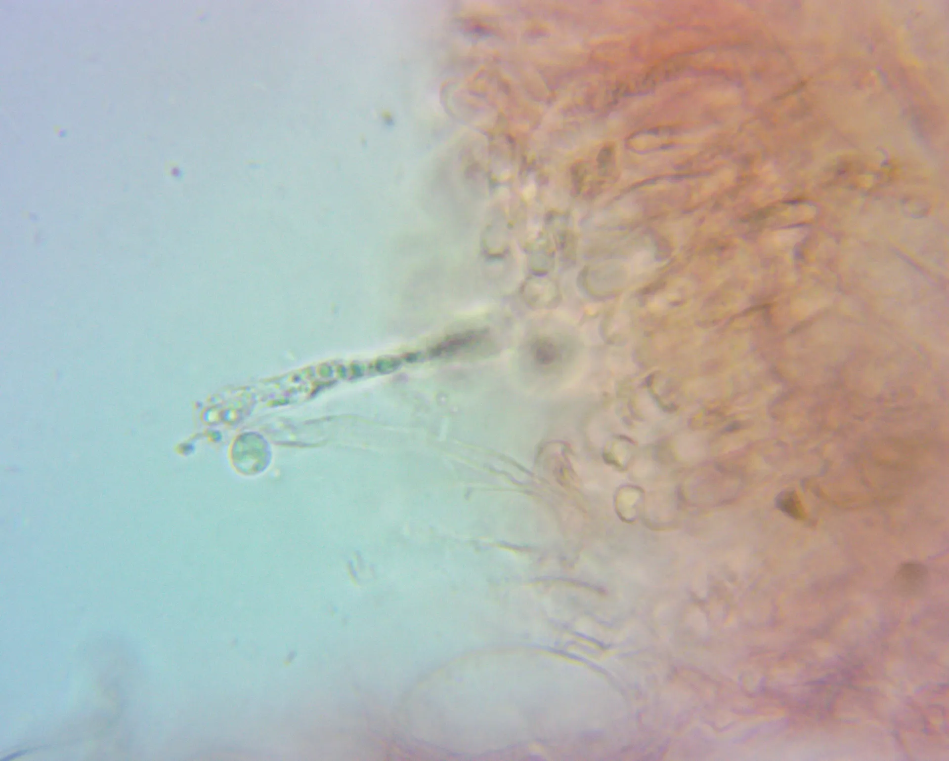 Microscopía de Hodophilus anatinus - basidio
