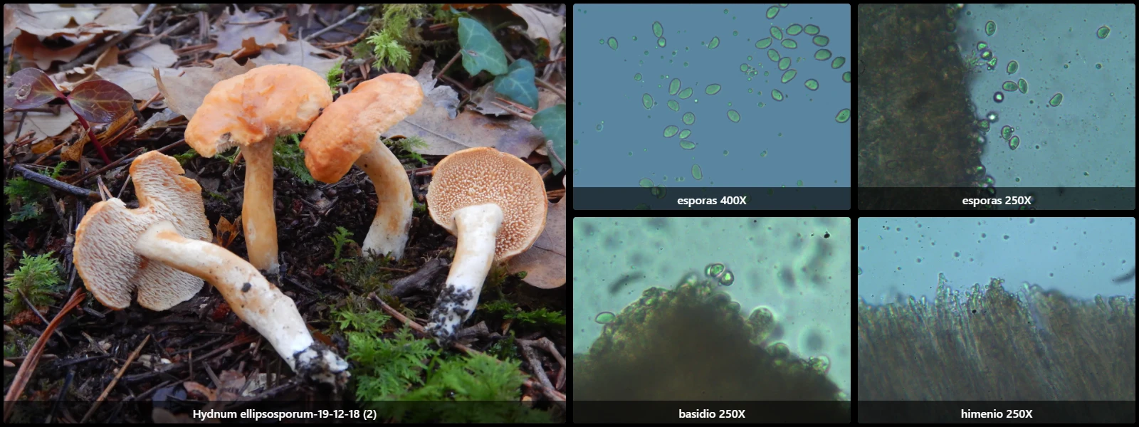 Microscopía de Hydnum ellipsosporum
