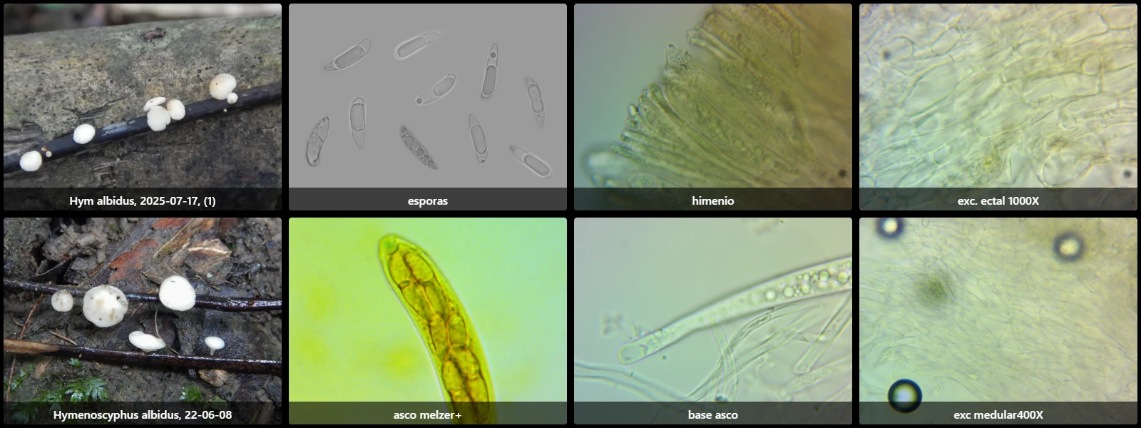 Microscopía de Hymenoscyphus albidus