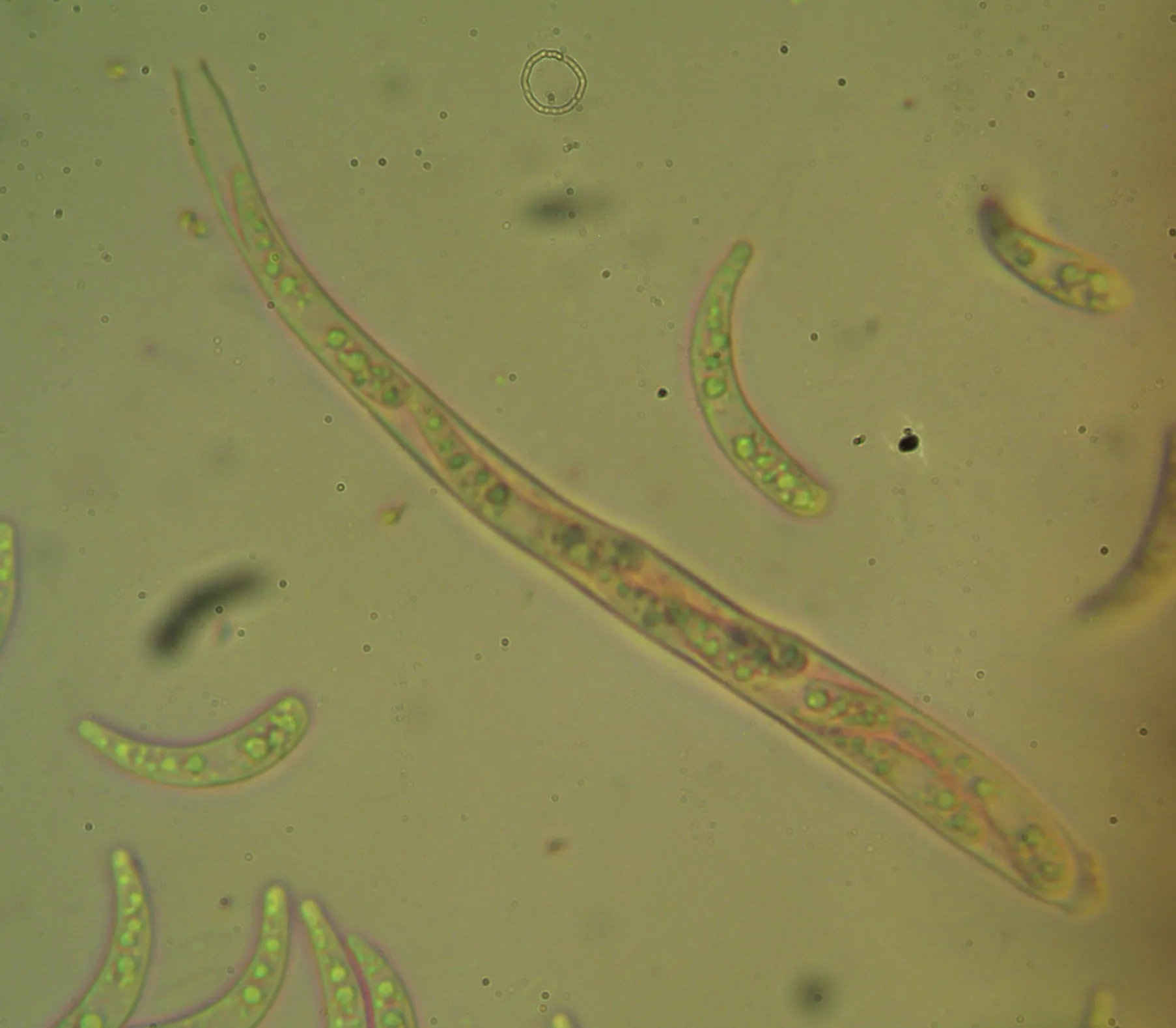 Microscopía de Hymenoscyphus serotinus - asco