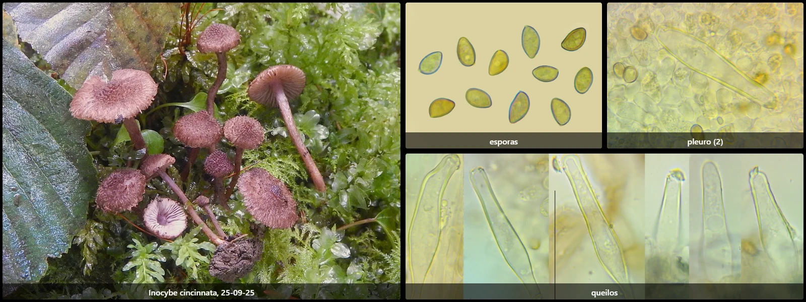 Microscopía de Inocybe cincinnata