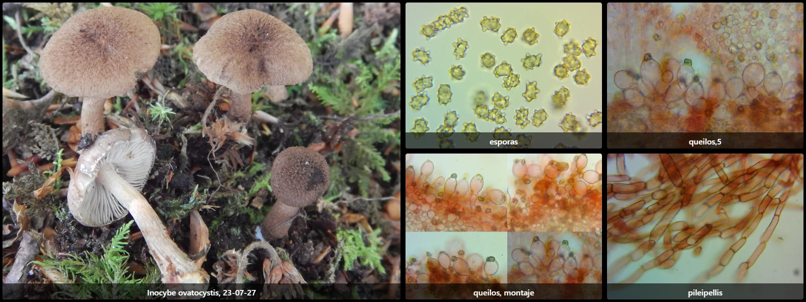 Microscopía de Inocybe ovatocystis