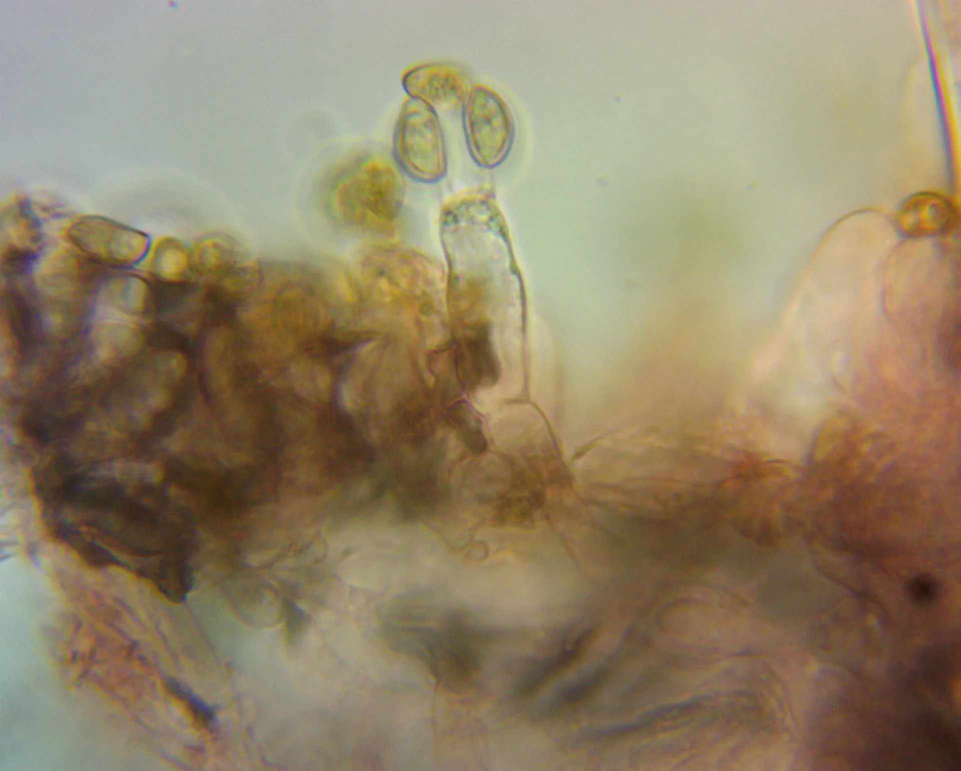 Microscopía de Inocybe sindonia - basidio1000x-2