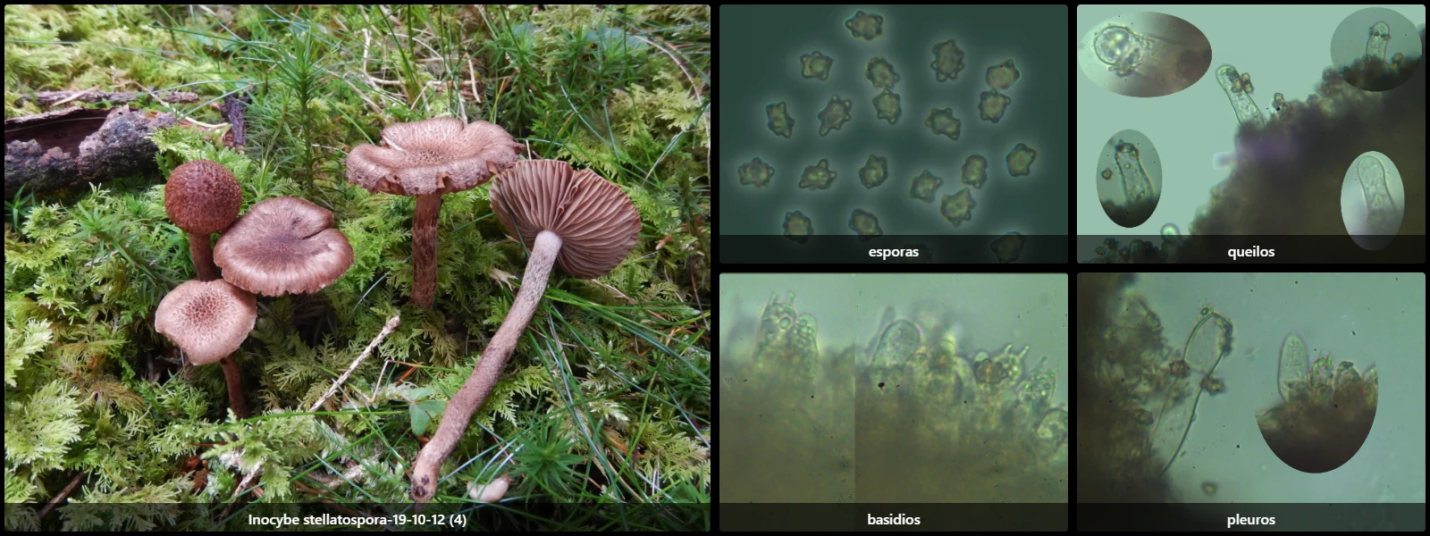 Microscopía de Inocybe stellatospora