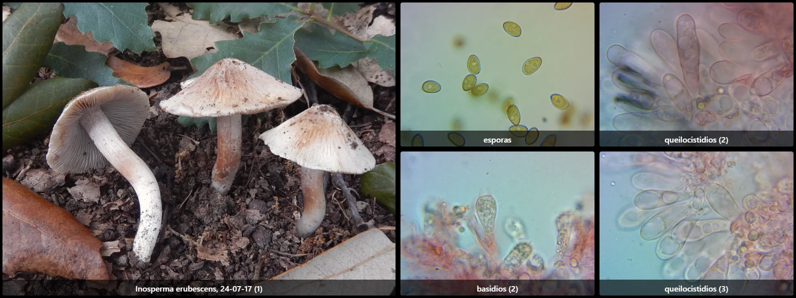 Microscopía de Inosperma erubescens