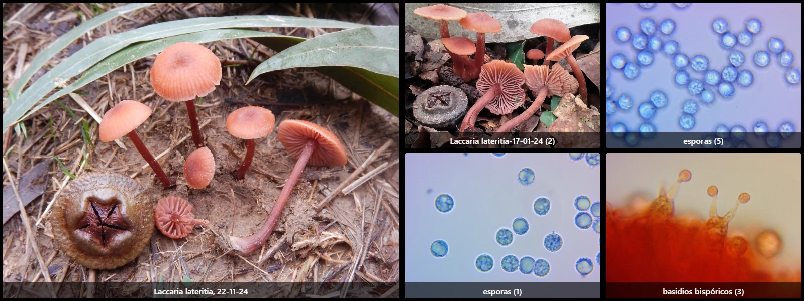 Microscopía de Laccaria lateritia