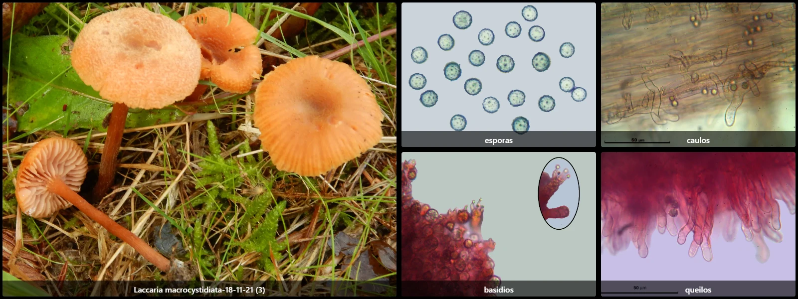 Microscopía de Laccaria macrocystidiata