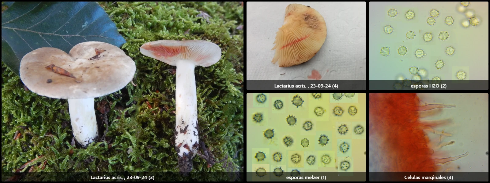 Microscopía de Lactarius acris