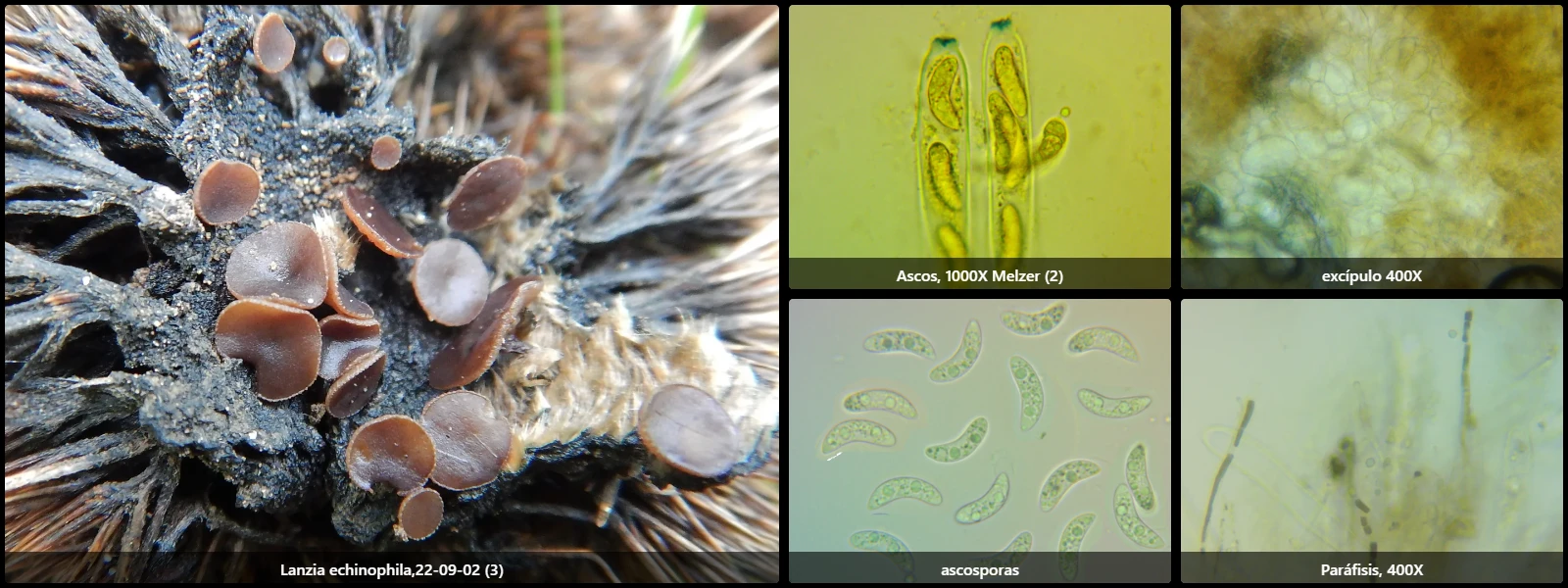 Microscopía de Lanzia echinophila
