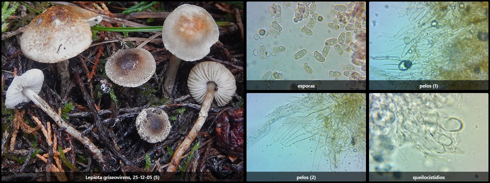 Microscopía de Lepiota griseovirens