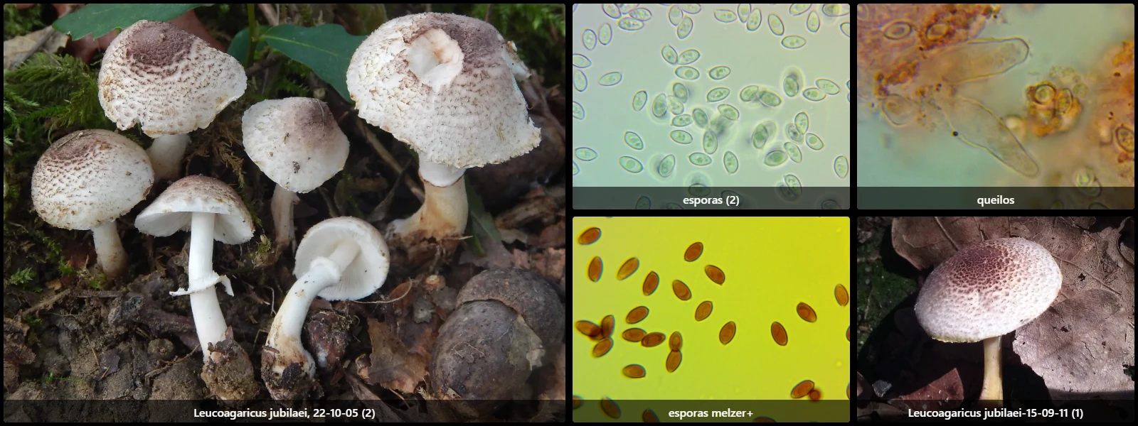 Microscopía de Leucoagaricus jubilaei