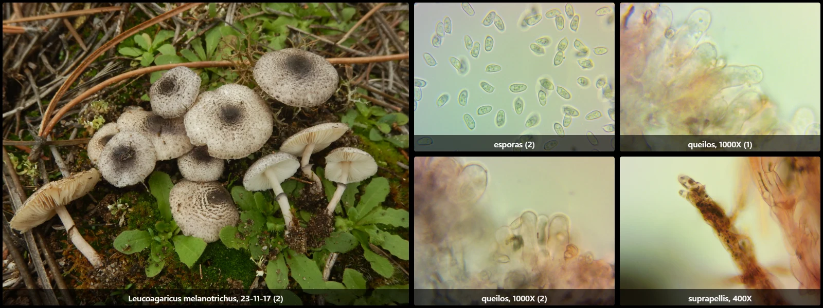 Microscopía de Leucoagaricus melanotrichus