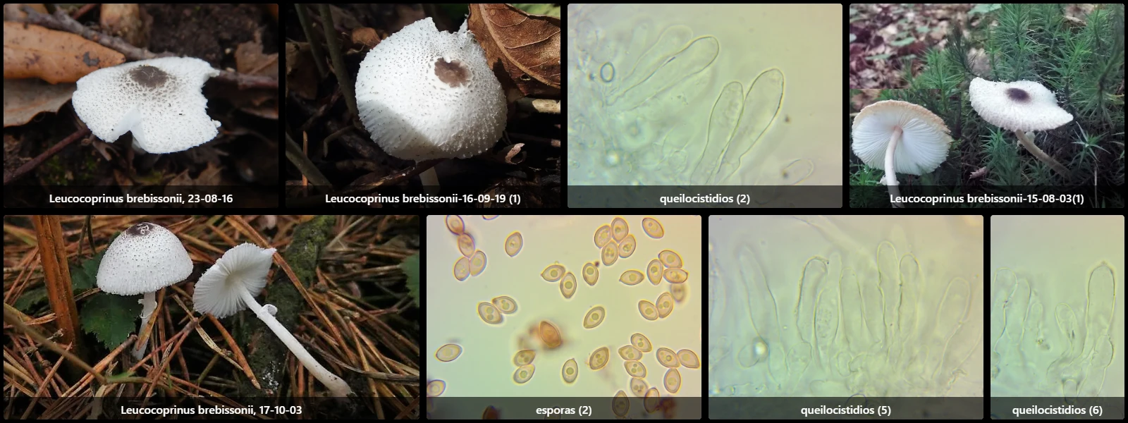 Microscopía de Leucocoprinus brebissonii