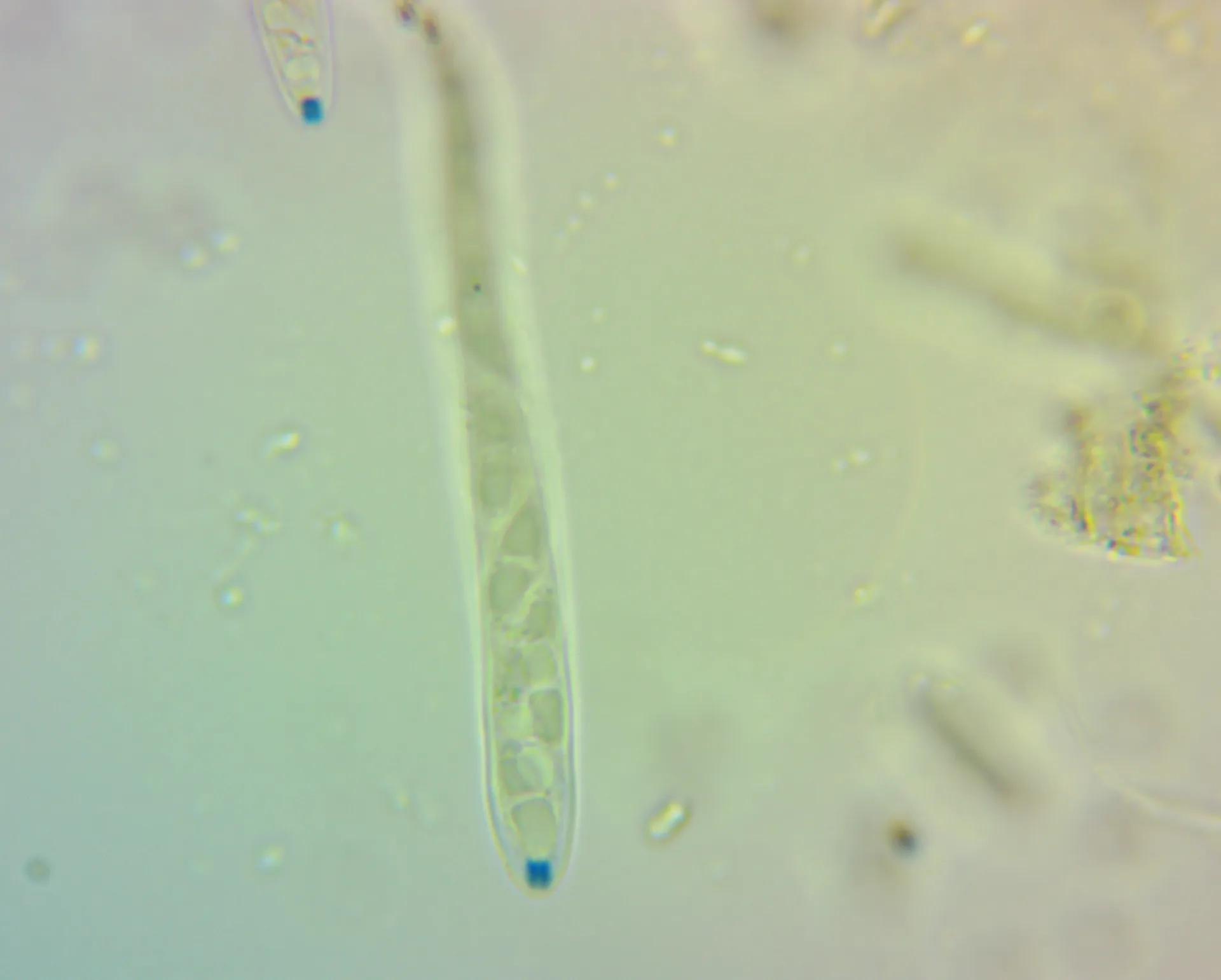 Microscopía de Microglossum tenebrosum - Melzer(+)