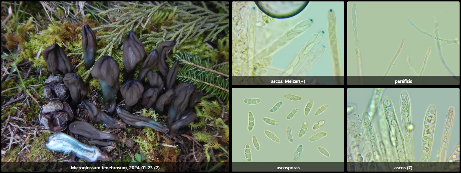 Microscopía de Microglossum tenebrosum
