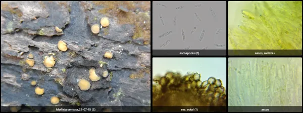 Microscopía de Mollisia ventosa
