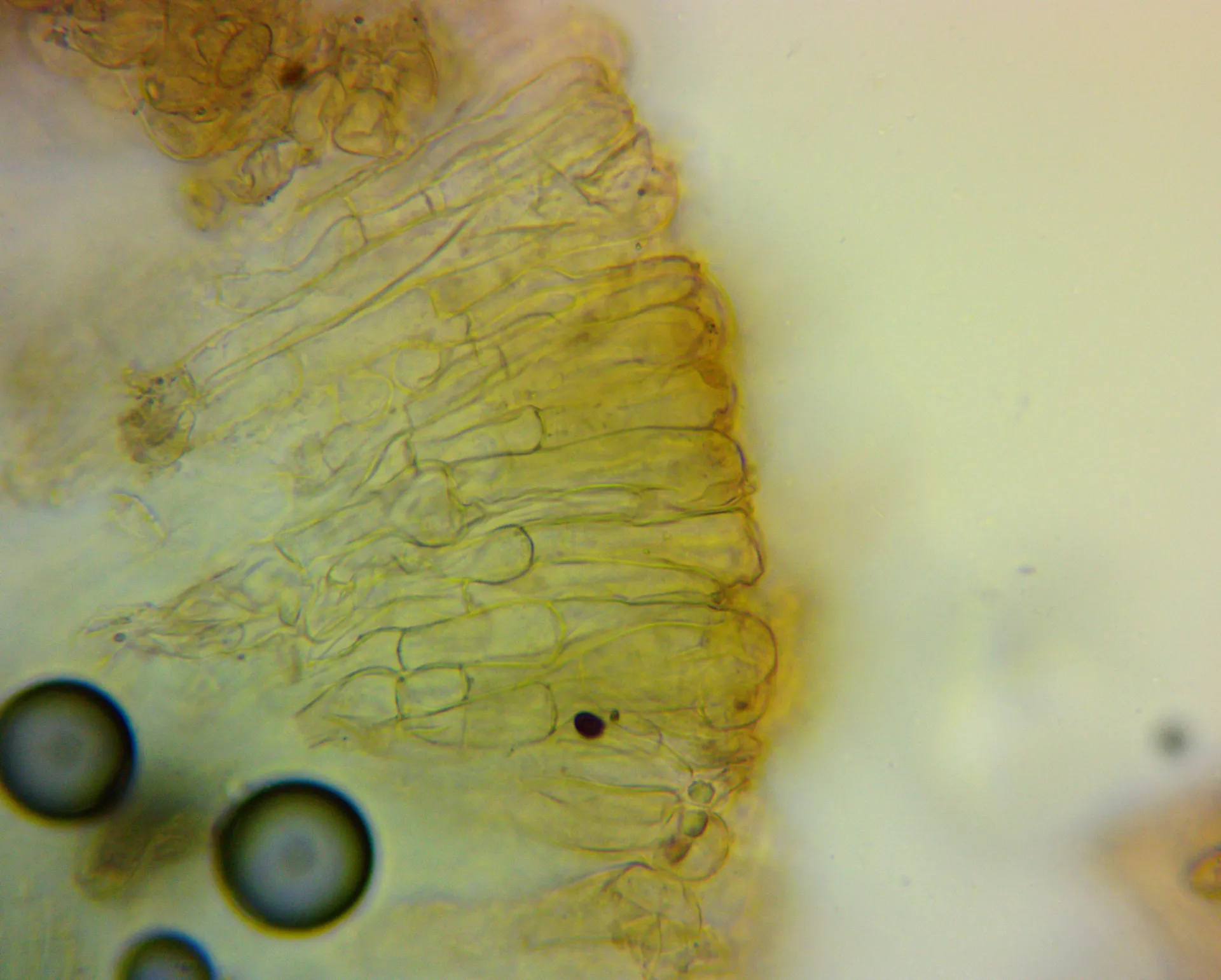 Microscopía de Morchella iberica - acroparáfisis