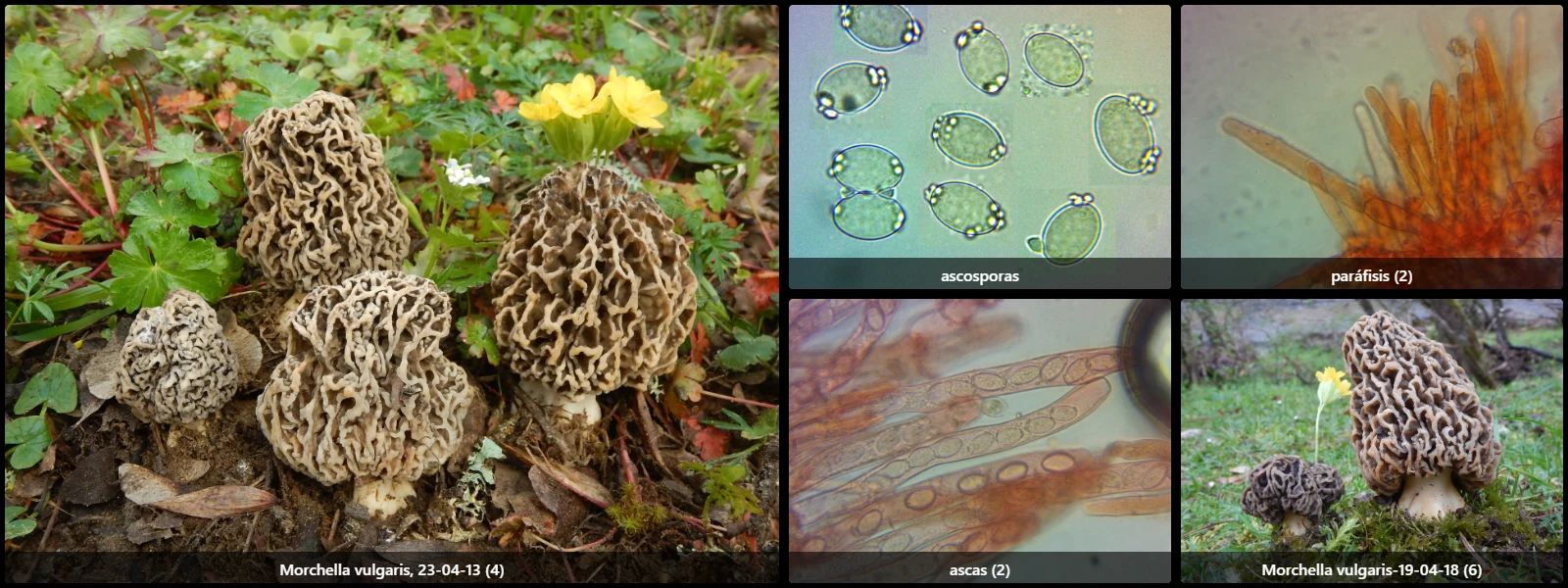Microscopía de Morchella vulgaris