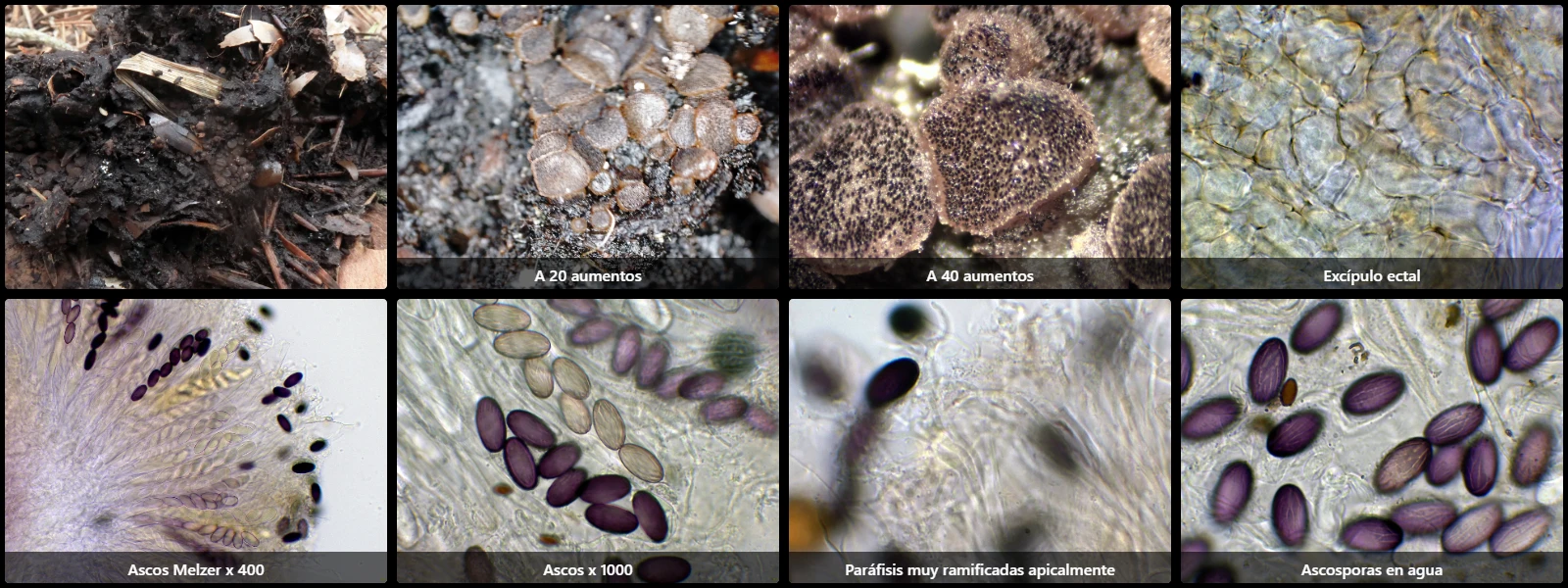 Microscopía de Ascobolus crenulatus