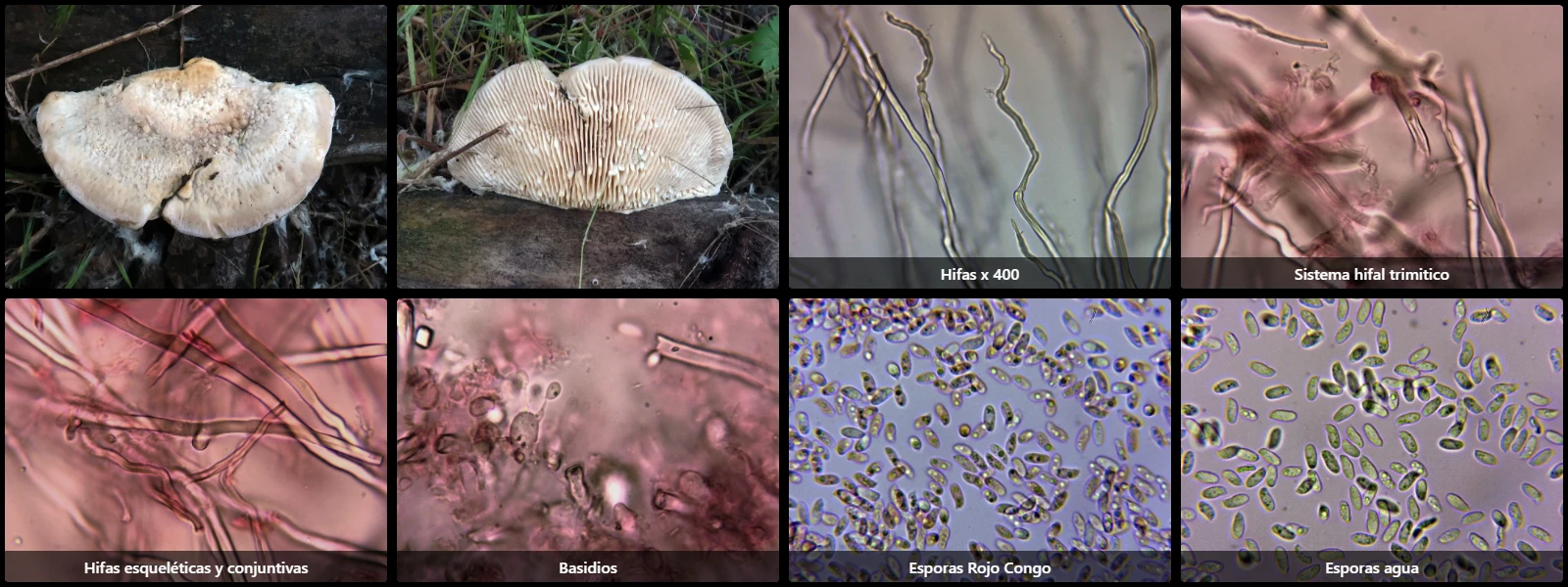 Microscopía de Cellulariella warnieri