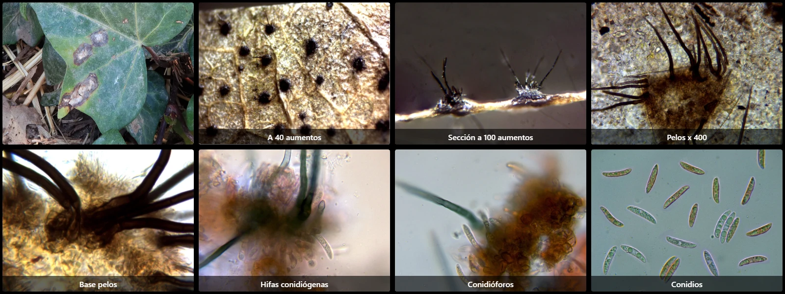 Colletotrichum trichellum