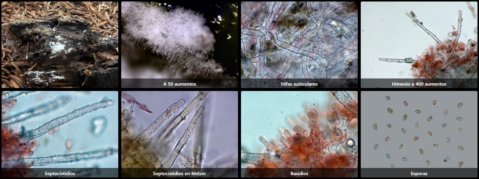 Microscopía de Gyrophanopsis polonensis