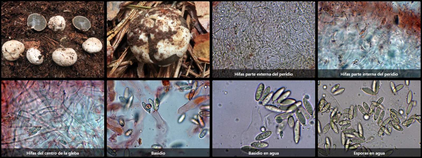 Microscopía de Hysterangium coriaceum