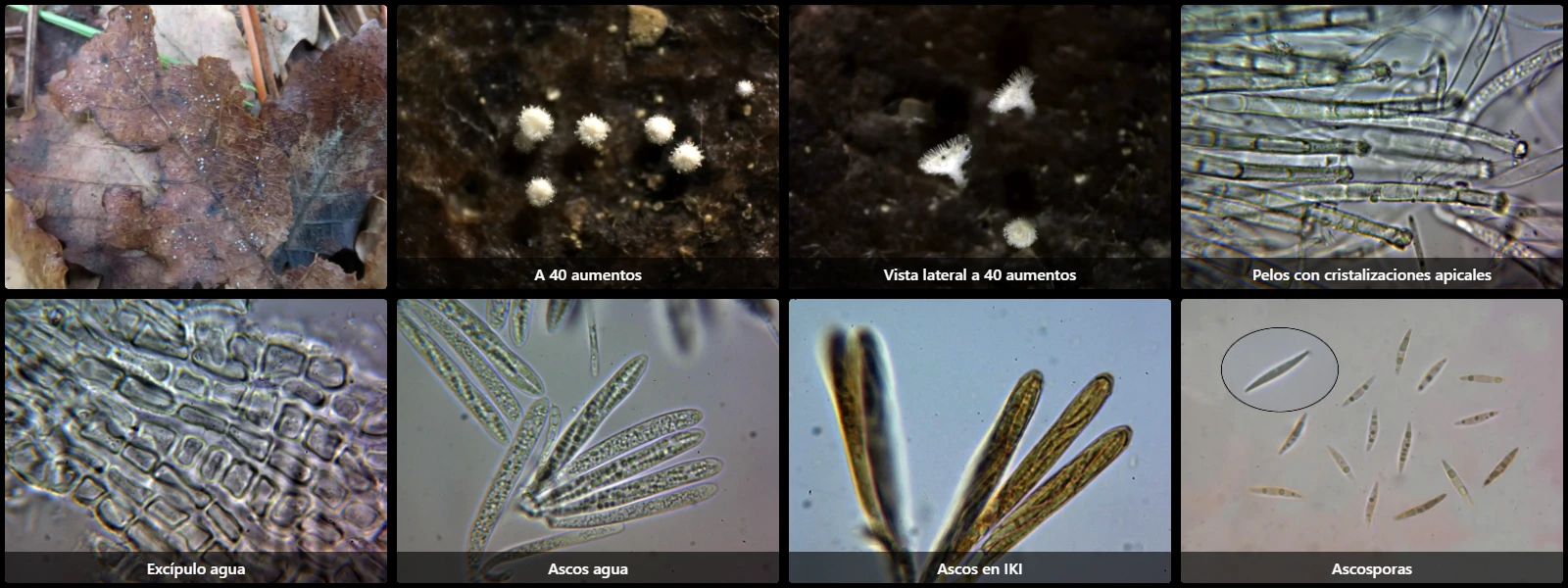 Incrucipulum ciliare